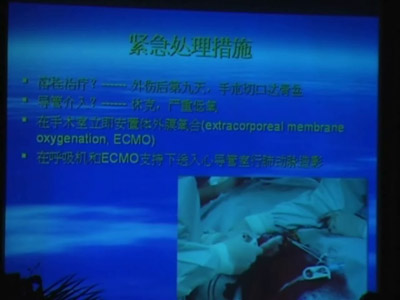 [GWICC2009]急性肺栓塞体外膜氧合加到死碎栓术抢救成功一例          